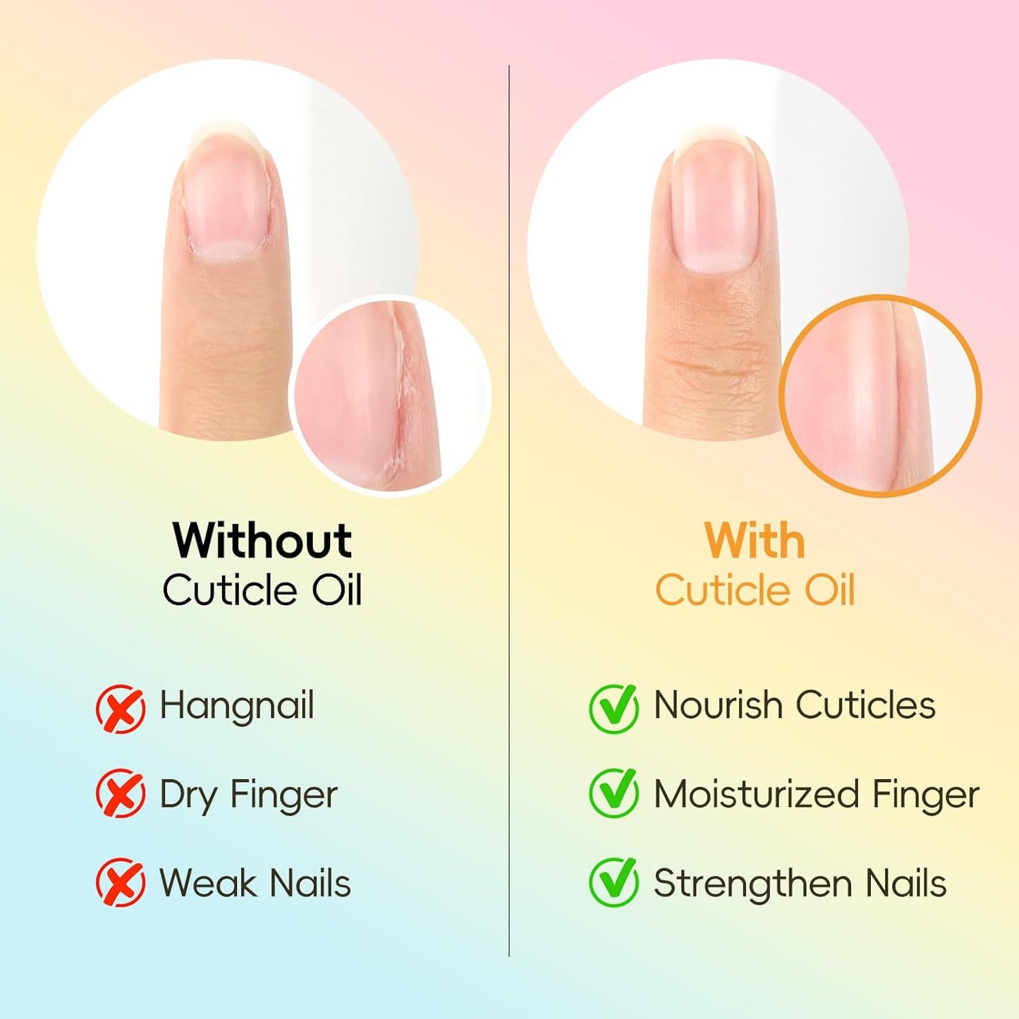 Top Pick: COSCELIA Cuticle Revitalizer Pens for Gel Nails