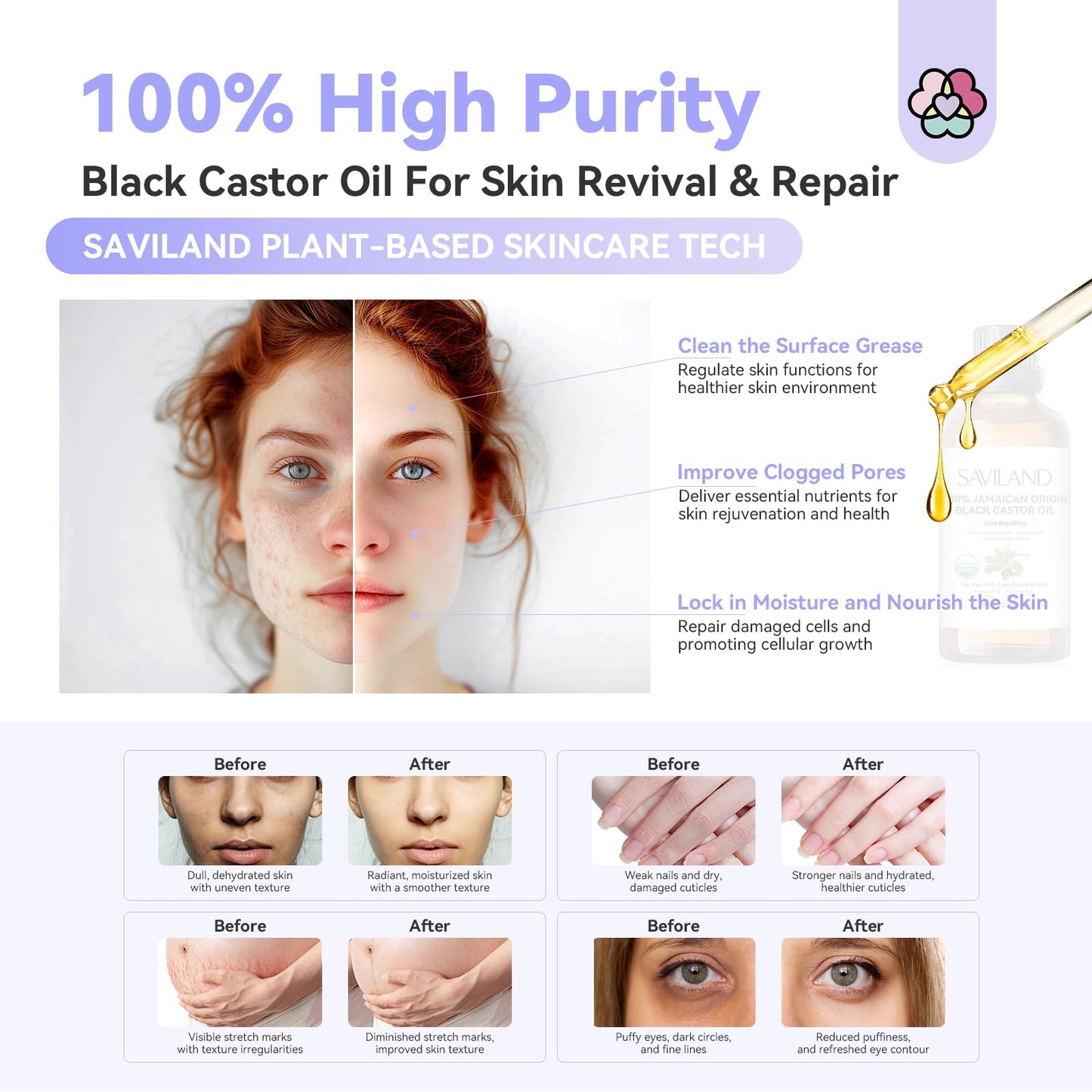 Best Natural Cuticle Oil – Saviland with Vitamin E Boost